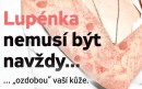 Mobilní aplikace usnadní život nemocným s lupénkou